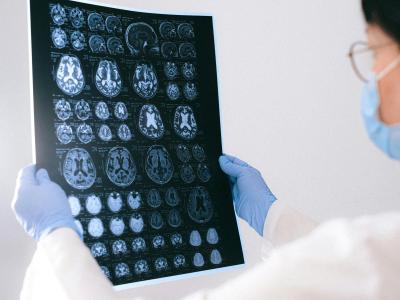 Hjernescanning
